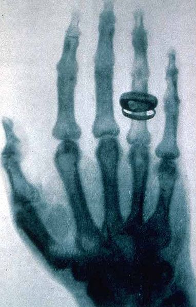 x ray.jpg