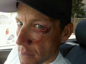 Lance Armstrong crashes out of Stage 5 of Tour of California