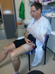 Mark Canning in hospital after being hit (courtesy Elise Canning)