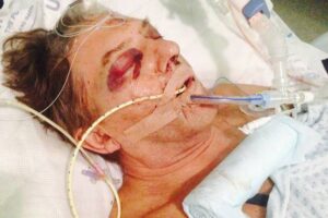 Michael Mason in St Mary’s Hospital