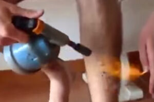 Leg shaving with a blow torch