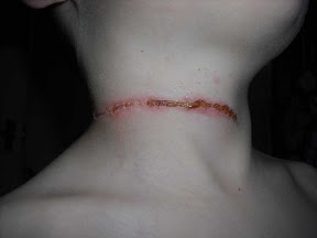 Dog lead neck injury.jpg