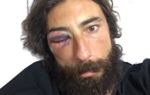 Vittorio Brumotti pre-eye operation (source Brumottistar on Twitter, cropped)