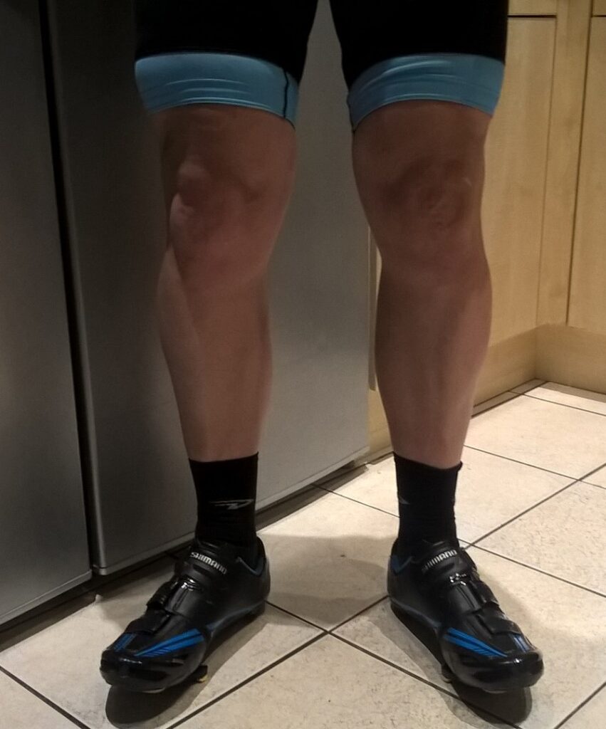 The legs are back.jpg