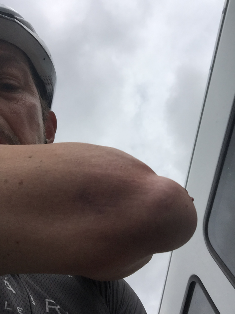 Elbow ouch