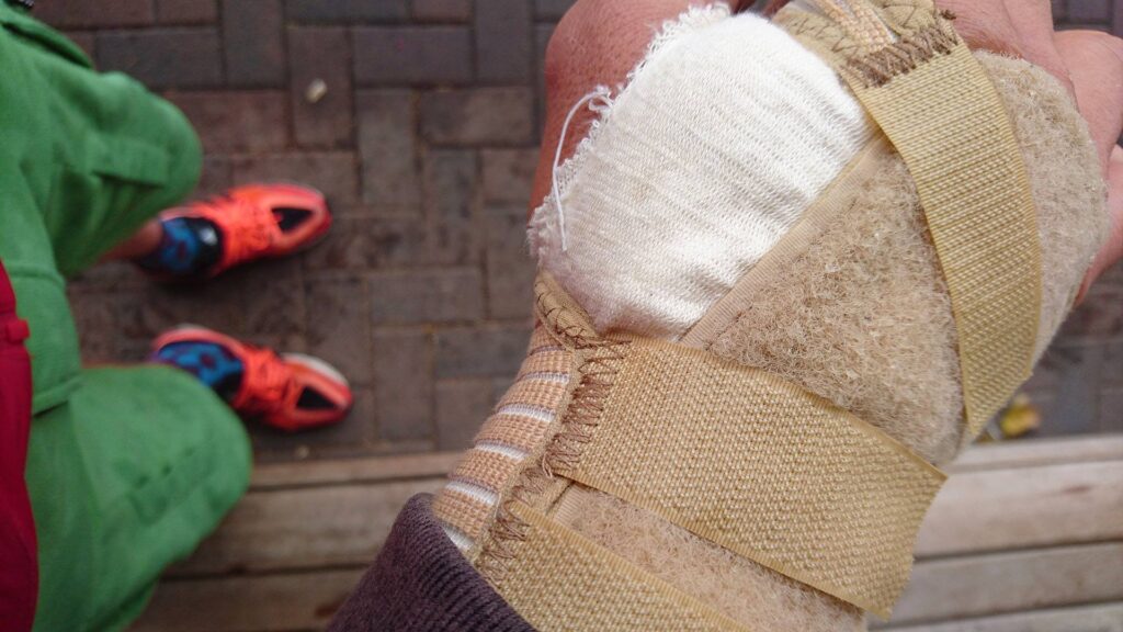 Crash wrist