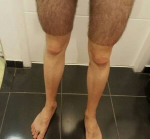Summer shorts (picture – Imgur user Hyddrox).jpg