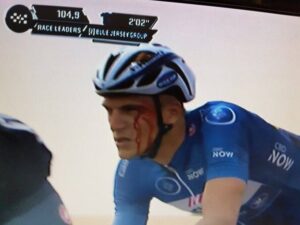 Marcel Kittel bloodied at Dubai Tour.jpg
