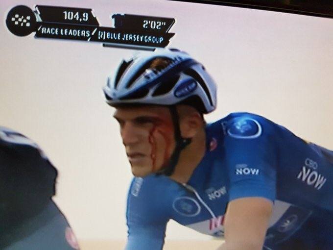 Marcel Kittel bloodied at Dubai Tour.jpg