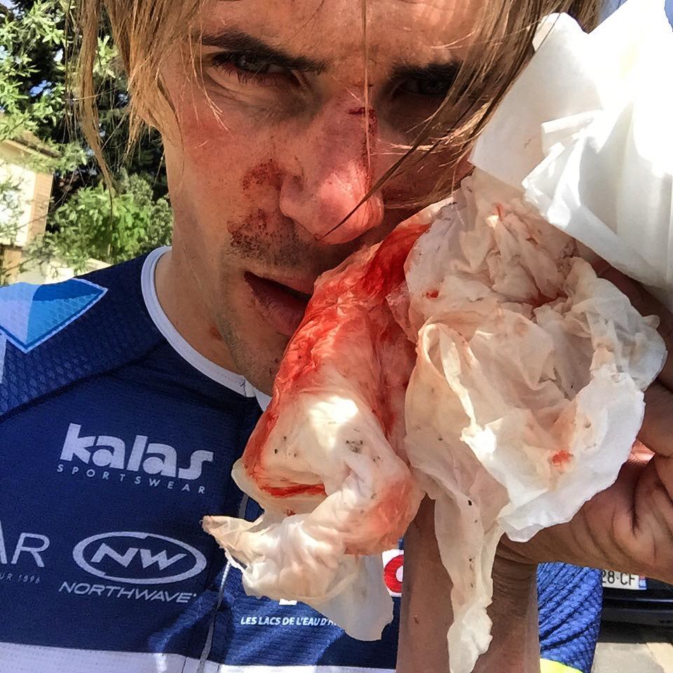 Yoann Offredo following assault during training ride (via Facebook).jpg