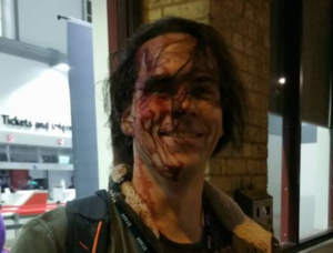 Johan Henriksson following assault (source – Facerbook).PNG