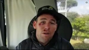 Mark Cavendish after Tirreno Adriatico crash (via Team Dimension Data on Twitter).JPG