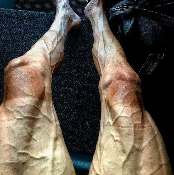 Pawel Poljanski&rsquo;s legs (via Instagram).jpg