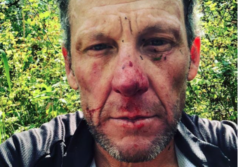 Lance Armstrong crash injury
