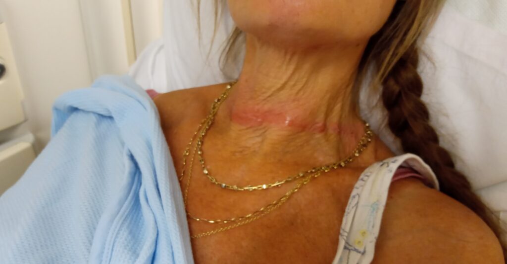 Jan Binning injury (picture via Dorset Police)