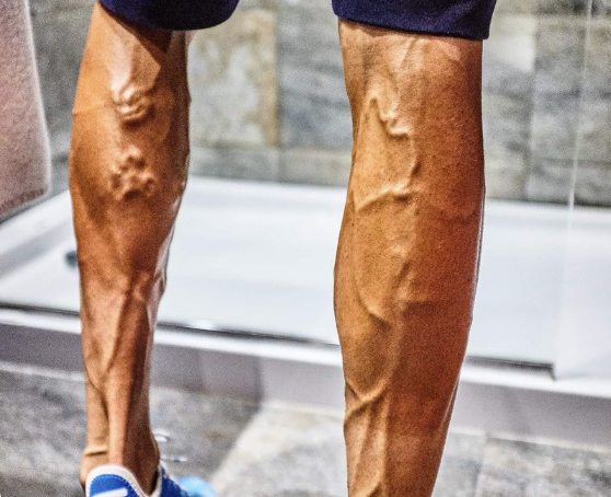 nicolau legs 2