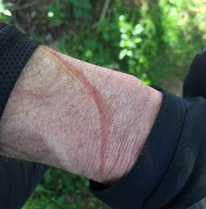 Wetherby cyclist&rsquo;s injury (via West Yorkshire Police).PNG