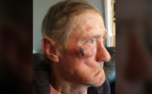 Injured cyclist in Sunderland.PNG