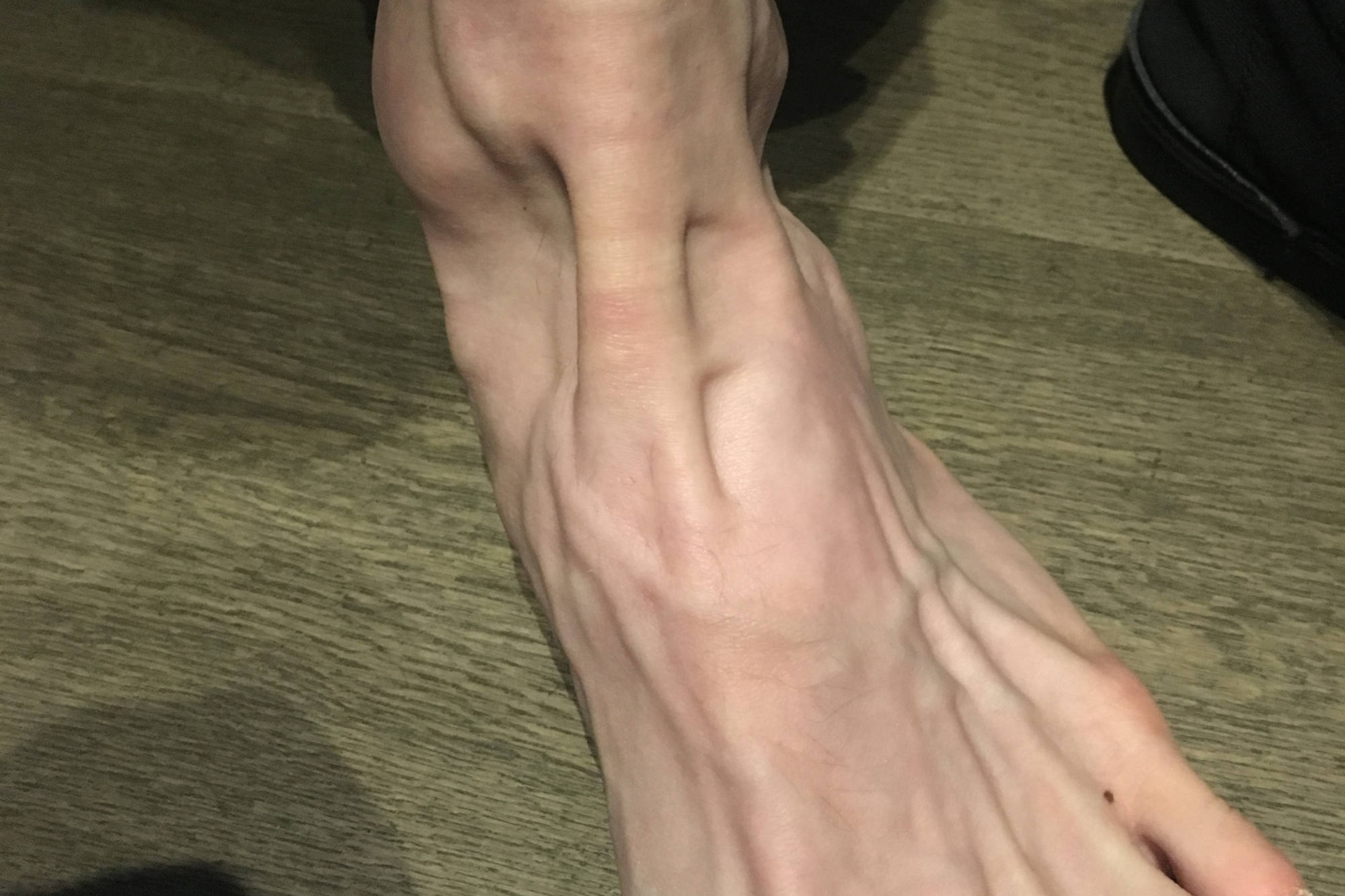 Sam Bennett tendon