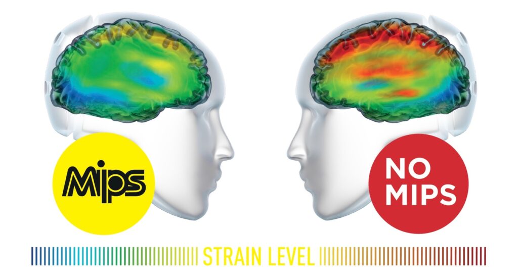 MIPS strain – 1