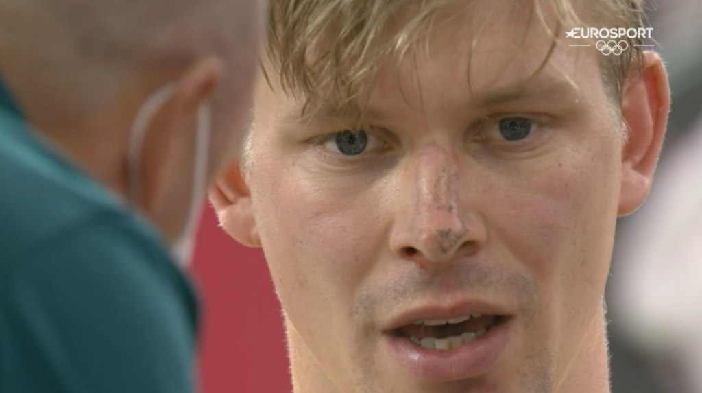 Alex Porter injuries