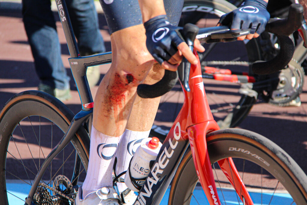 Ben Turner Knee Injury Paris-Roubaix 2022