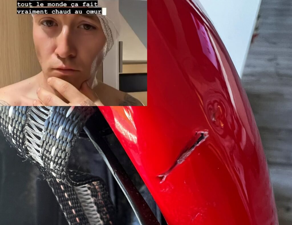 Hugo Hofstetter disc brake injury