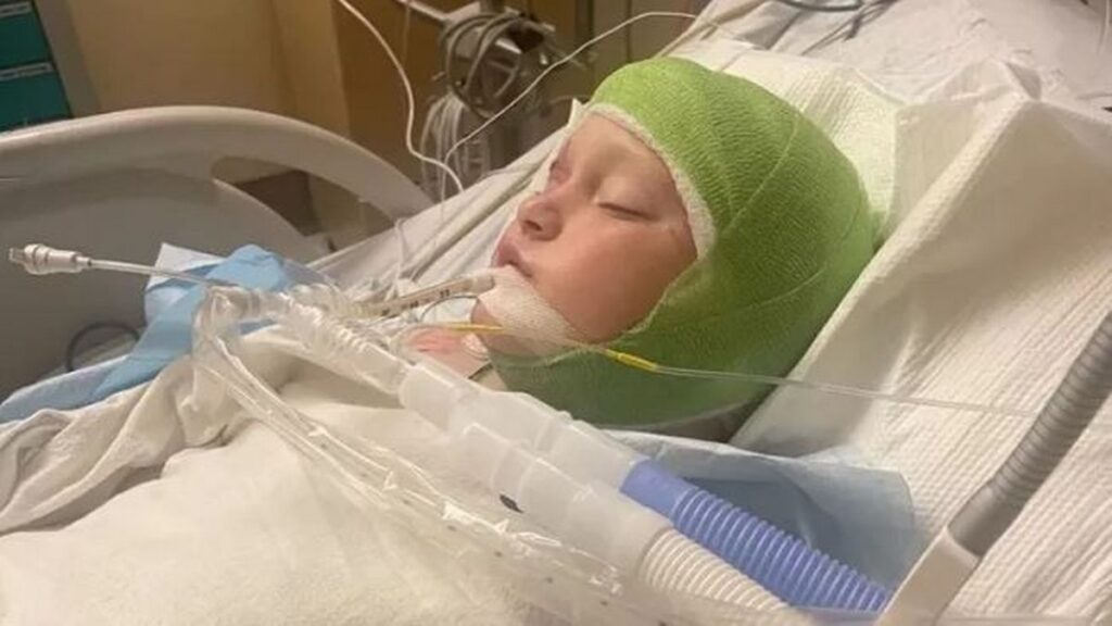 Cyclist, 11, dragged from bike during pit bull attack