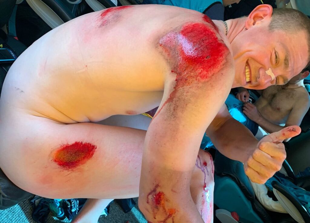 Gleb Syritsa road rash