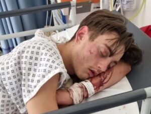 Teenage cyclist, after hit-and-run in Birmingham