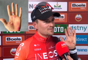 Tom Pidcock shows off Paris-Roubaix blisters having won Amstel Gold