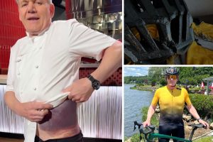 Gordon Ramsay’s bruise and helmet after cycling accident
