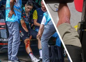 Wout van Aert knee injury after 2024 Vuelta crash