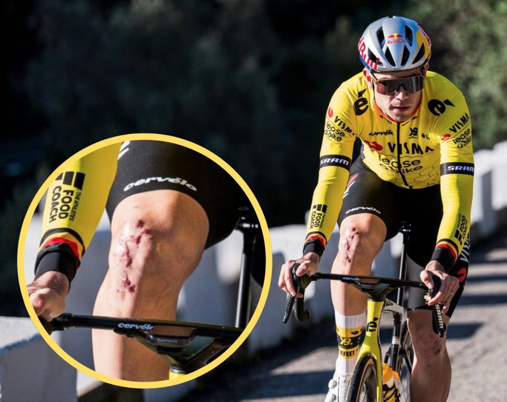 Wout van Aert knee injury
