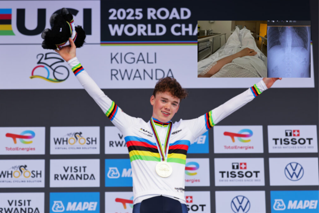 Harry Hudson fractured vertebra