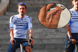 “On a positive note I am now 10g lighter #marginal gains”: Pro out of Tour de France after losing part of thumb in crash; “Ridiculous” cycle lane shortened leaving cyclists stranded; Today’s Tour stage ripe for a mountain ambush? + more on the live blog