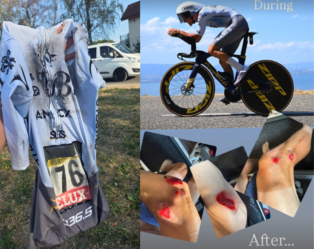Xandro Meurisse post-crash