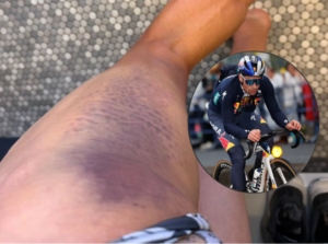 Primoz Roglic hit by driver