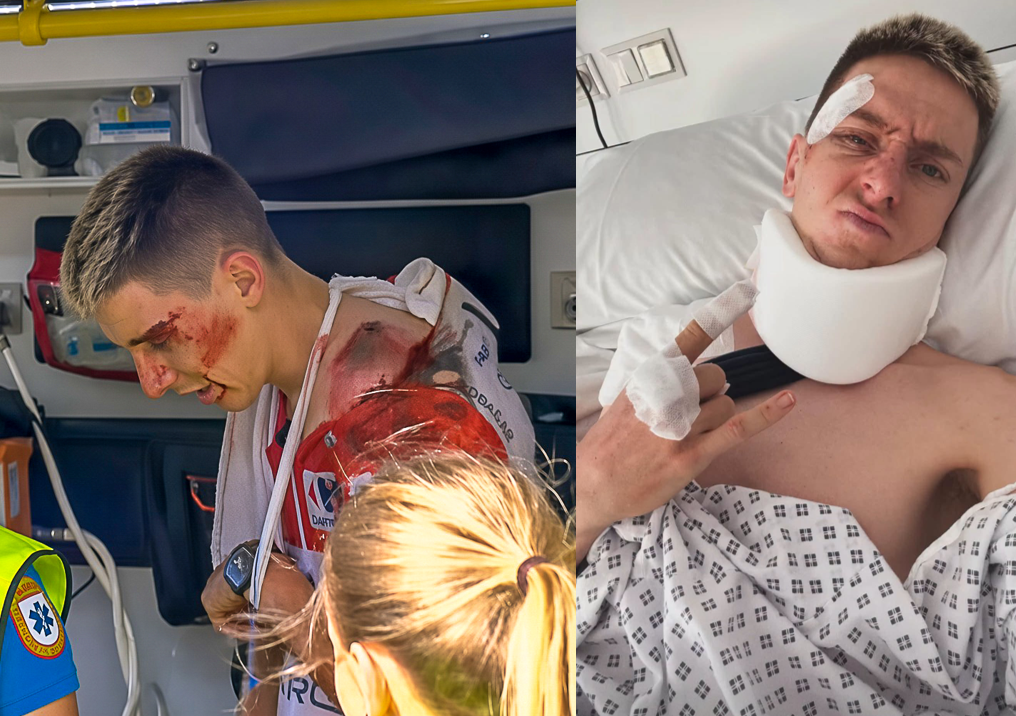 Tadej Pogačar’s collarbone surgery successful after crashing out of Vuelta in red jersey – but timeline for racing return still unclear