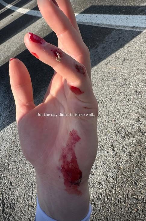 Demi Vollering injures hand during training crash