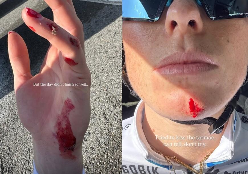 Demi Vollering sustains hands and injuries in training crash in Spain