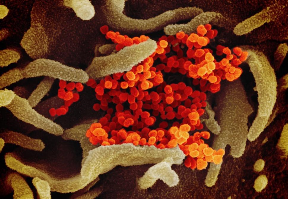 Novel Coronavirus SARS-CoV-2 - 1