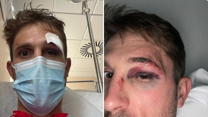 Cofidis pro Rub&eacute;n Fern&aacute;ndez injured in collision with motorist who ran stop sign (Twitter/X)