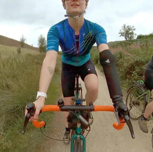 "World-first" prosthetic for cyclists