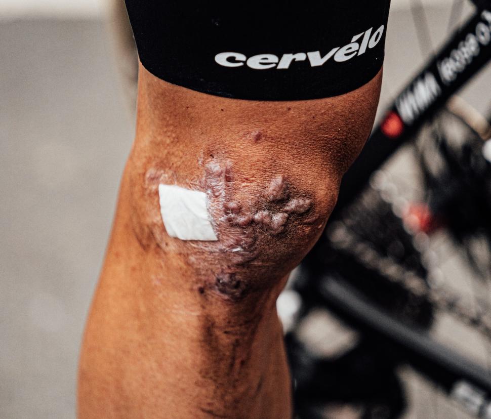 2025 Wout van Aert scars Zac Williams/SWpix.com
