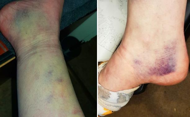 Cyclist hit by driver, reported to GMP