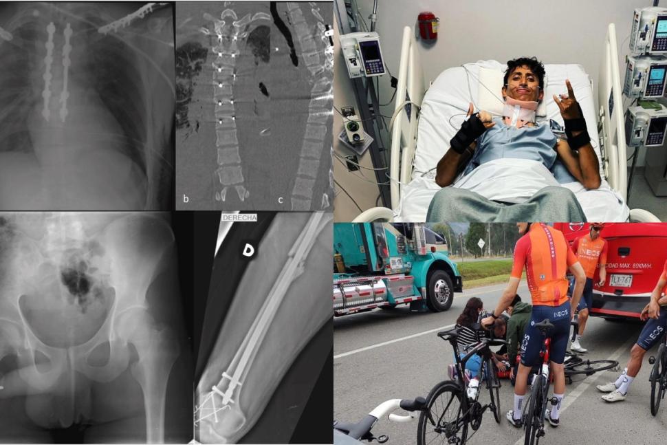 Egan Bernal recovery from horror crash detailed in medical paper