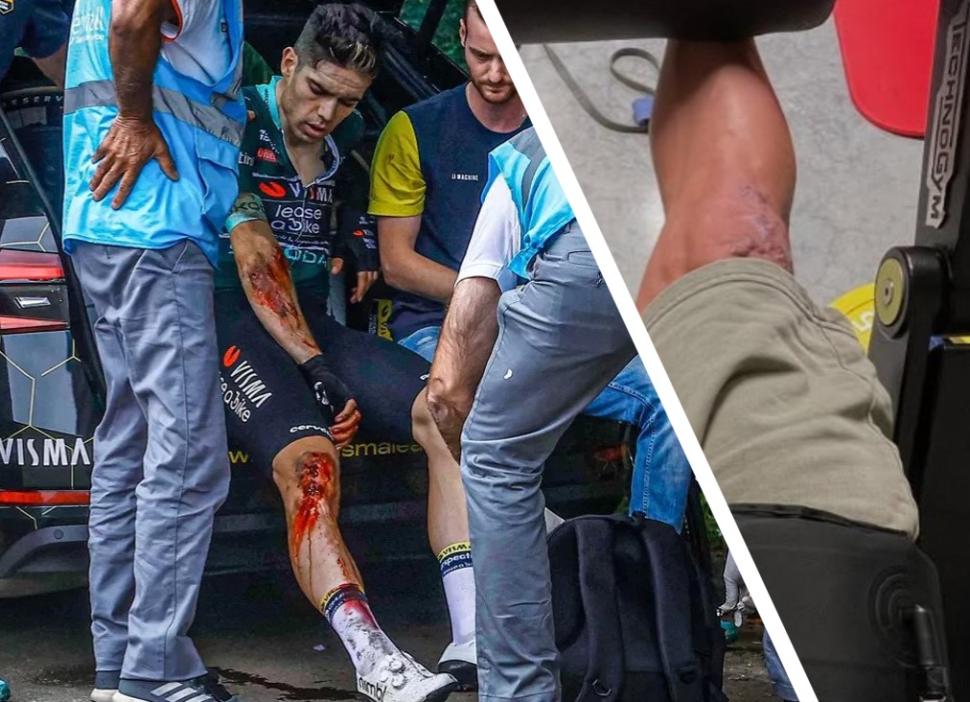 Wout van Aert knee injury after 2024 Vuelta crash (Photonews,Instagram)