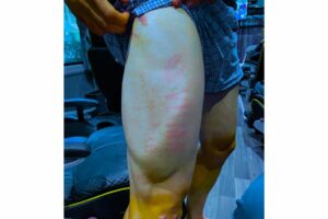 Visma-Lease a Bike logo sunburnt on Wout van Aert’s thigh